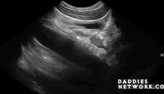 Doctor Makes Twink's Hole Whole