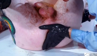 Fisting Porno Archives 1-9