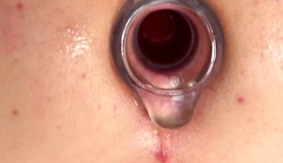 Im just a hole
