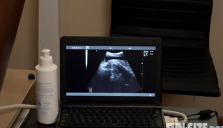 ultrasound