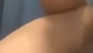 Hairy anal
