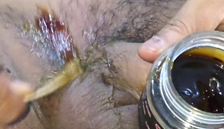 Myanmar gay self Pubic hair waxing